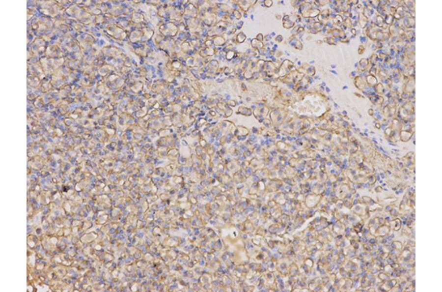 Immunohistochemistry - TYMP Antibody from Signalway Antibody (32154) - Antibodies.com