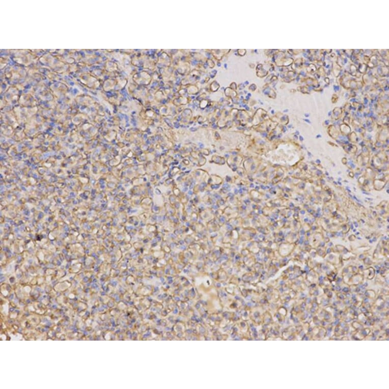Immunohistochemistry - TYMP Antibody from Signalway Antibody (32154) - Antibodies.com
