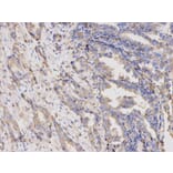 Immunohistochemistry - TYMP Antibody from Signalway Antibody (32154) - Antibodies.com