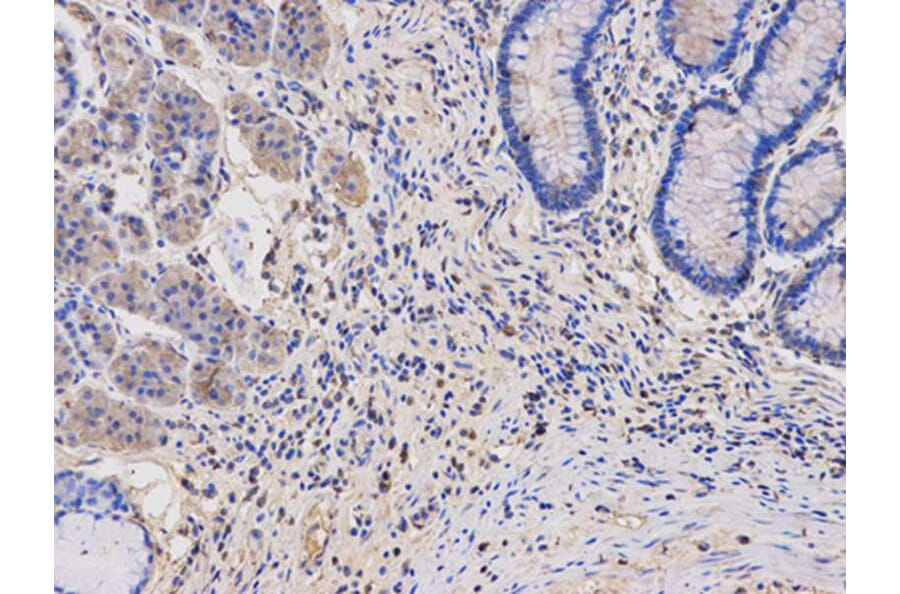 Immunohistochemistry - TYMP Antibody from Signalway Antibody (32154) - Antibodies.com