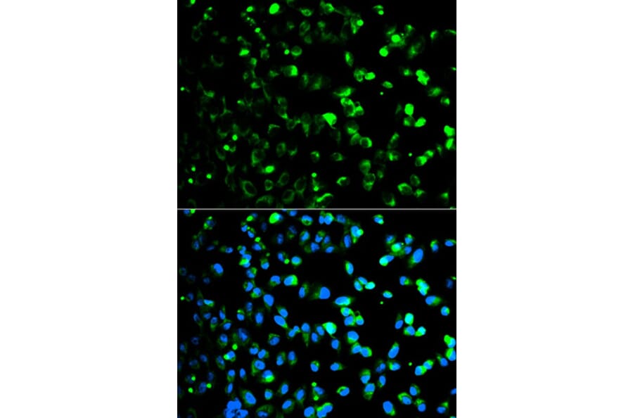 Immunofluorescence - TYMP Antibody from Signalway Antibody (32154) - Antibodies.com