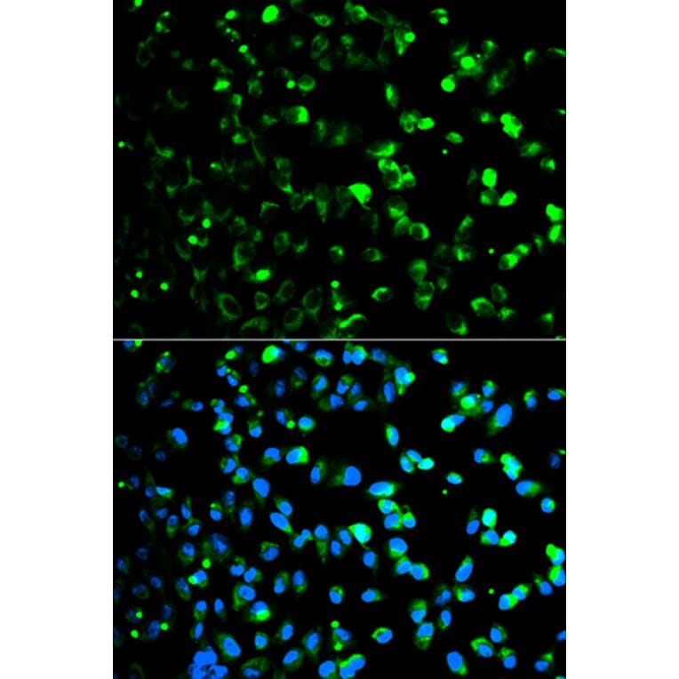 Immunofluorescence - TYMP Antibody from Signalway Antibody (32154) - Antibodies.com