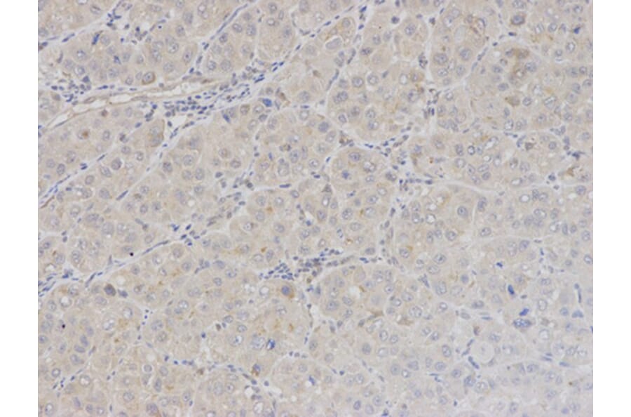 Immunohistochemistry - BAG1 Antibody from Signalway Antibody (32161) - Antibodies.com