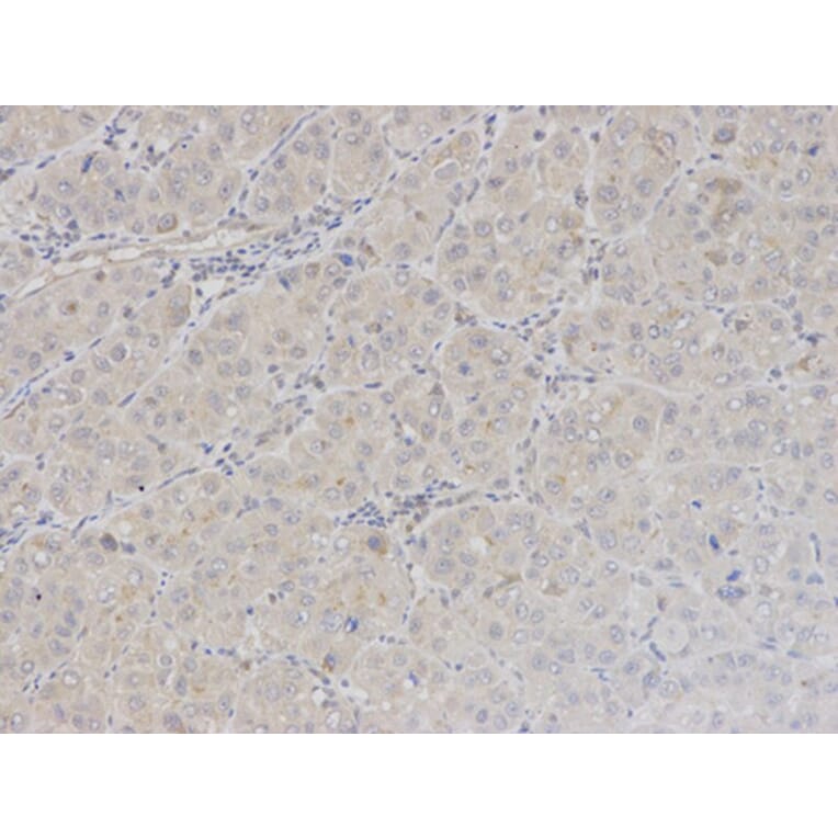 Immunohistochemistry - BAG1 Antibody from Signalway Antibody (32161) - Antibodies.com