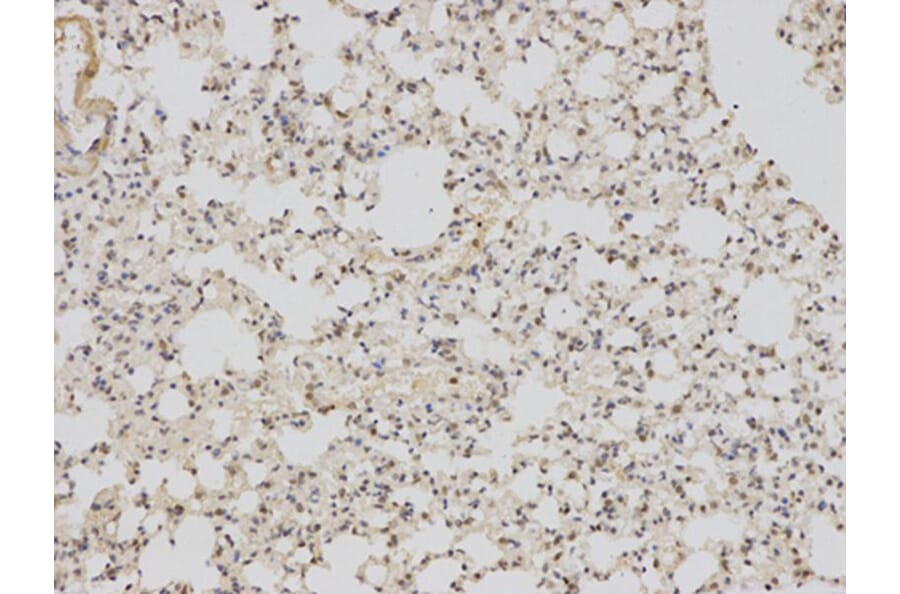 Immunohistochemistry - BAG1 Antibody from Signalway Antibody (32161) - Antibodies.com