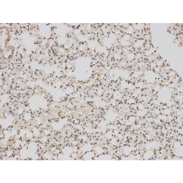 Immunohistochemistry - BAG1 Antibody from Signalway Antibody (32161) - Antibodies.com