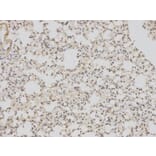 Immunohistochemistry - BAG1 Antibody from Signalway Antibody (32161) - Antibodies.com