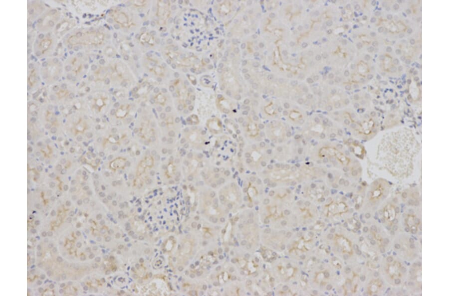 Immunohistochemistry - BAG1 Antibody from Signalway Antibody (32161) - Antibodies.com