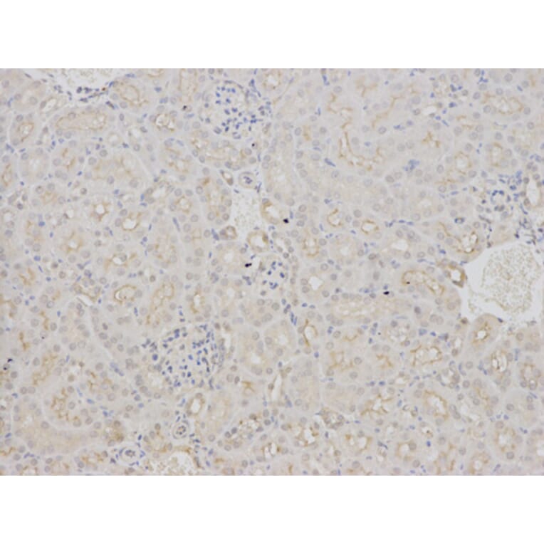 Immunohistochemistry - BAG1 Antibody from Signalway Antibody (32161) - Antibodies.com