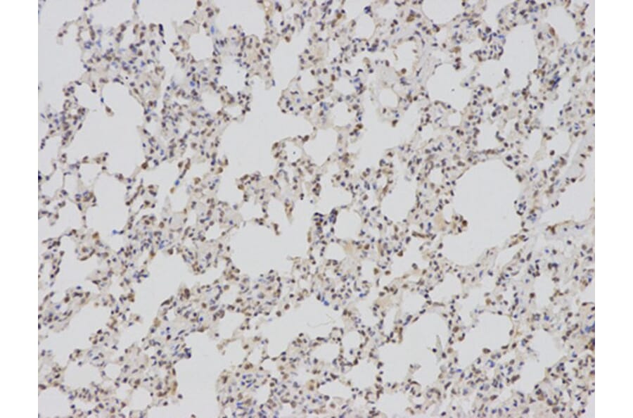 Immunohistochemistry - BAG1 Antibody from Signalway Antibody (32161) - Antibodies.com