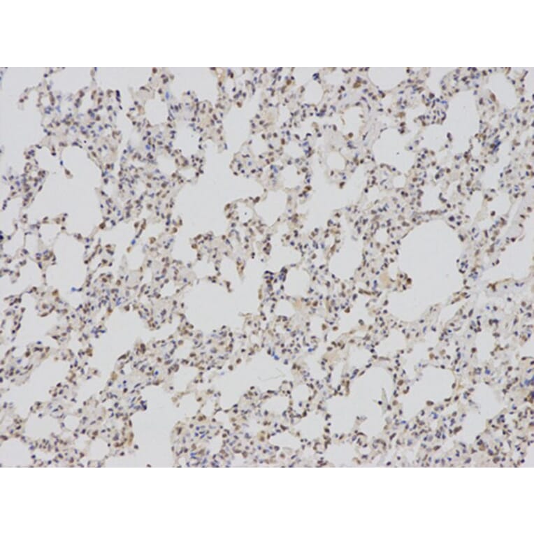 Immunohistochemistry - BAG1 Antibody from Signalway Antibody (32161) - Antibodies.com