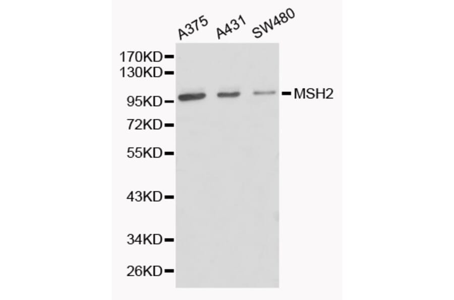 Western blot - MSH2 Antibody from Signalway Antibody (32169) - Antibodies.com