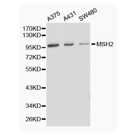 Western blot - MSH2 Antibody from Signalway Antibody (32169) - Antibodies.com