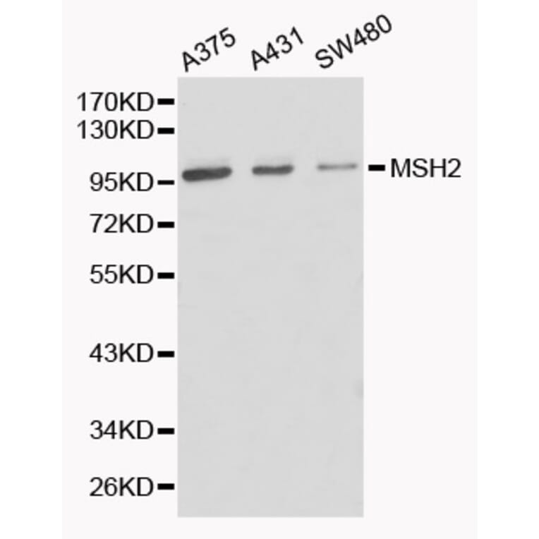 Western blot - MSH2 Antibody from Signalway Antibody (32169) - Antibodies.com