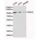 Western blot - MSH2 Antibody from Signalway Antibody (32169) - Antibodies.com
