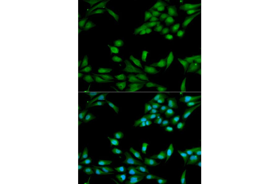 Immunofluorescence - MSH2 Antibody from Signalway Antibody (32169) - Antibodies.com