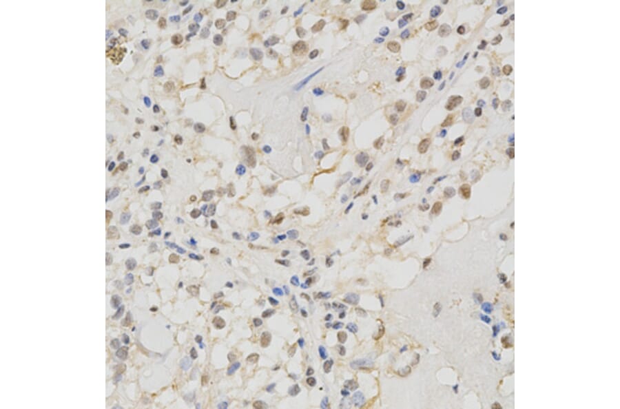 Immunohistochemistry - MSH2 Antibody from Signalway Antibody (32169) - Antibodies.com