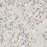 Immunohistochemistry - MSH2 Antibody from Signalway Antibody (32169) - Antibodies.com