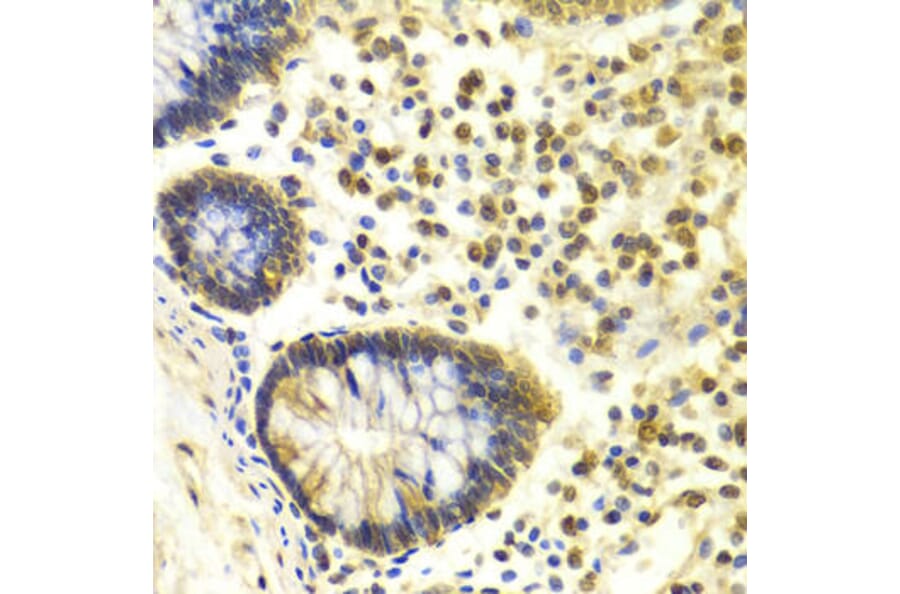 Immunohistochemistry - MSH2 Antibody from Signalway Antibody (32169) - Antibodies.com