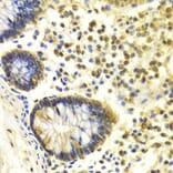 Immunohistochemistry - MSH2 Antibody from Signalway Antibody (32169) - Antibodies.com