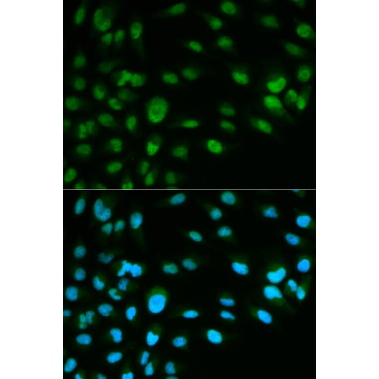 Immunofluorescence - MCM7 Antibody from Signalway Antibody (32176) - Antibodies.com