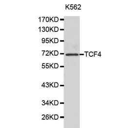 Western blot - TCF4 Antibody from Signalway Antibody (32177) - Antibodies.com