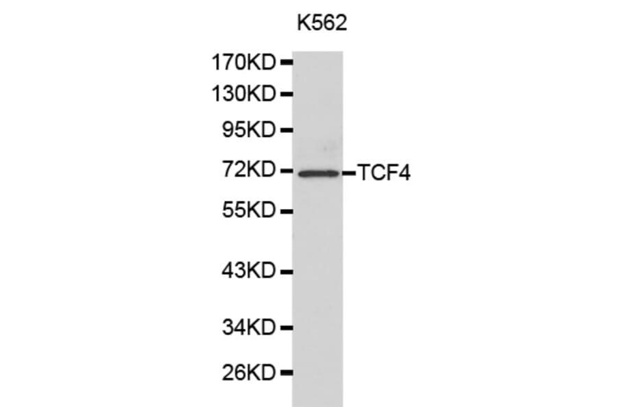Western blot - TCF4 Antibody from Signalway Antibody (32177) - Antibodies.com
