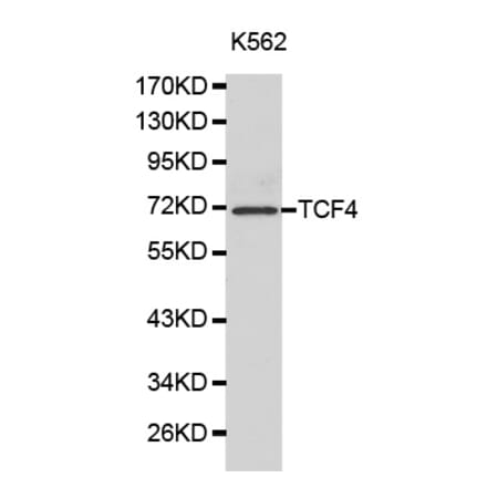 Western blot - TCF4 Antibody from Signalway Antibody (32177) - Antibodies.com