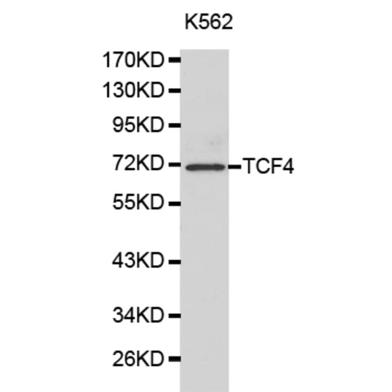 Western blot - TCF4 Antibody from Signalway Antibody (32177) - Antibodies.com