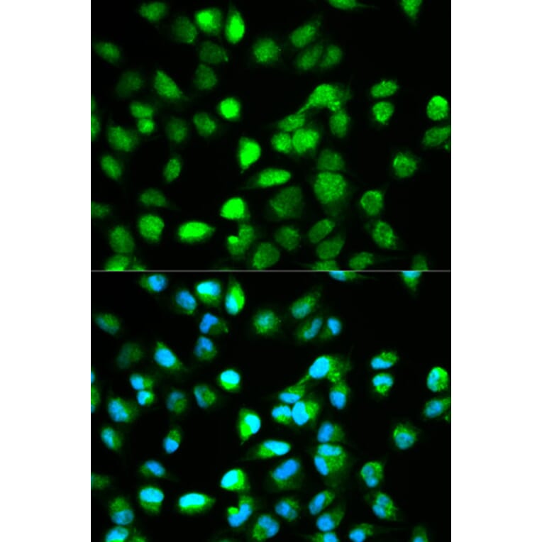 Immunofluorescence - TCF4 Antibody from Signalway Antibody (32177) - Antibodies.com