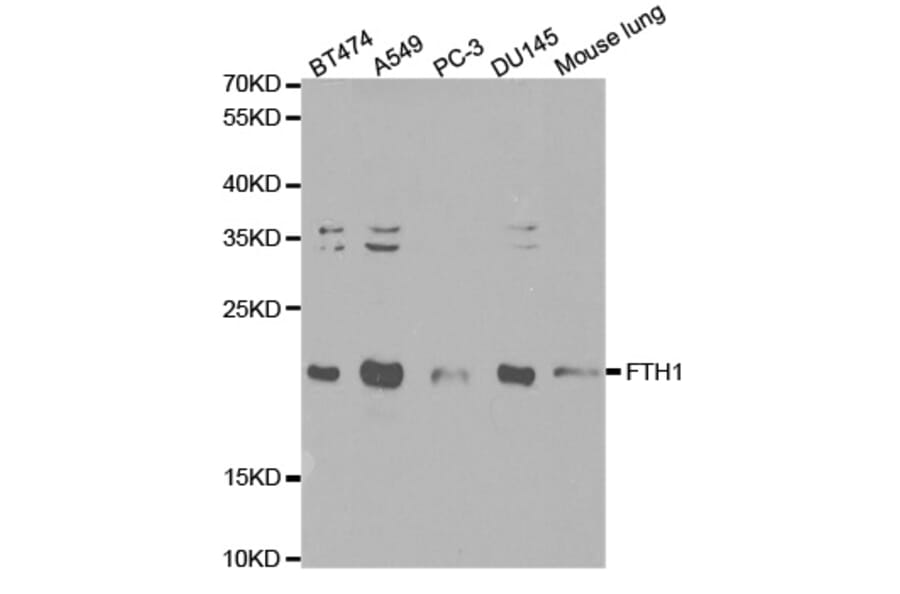 Western blot - FTH1 Antibody from Signalway Antibody (32180) - Antibodies.com