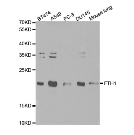 Western blot - FTH1 Antibody from Signalway Antibody (32180) - Antibodies.com