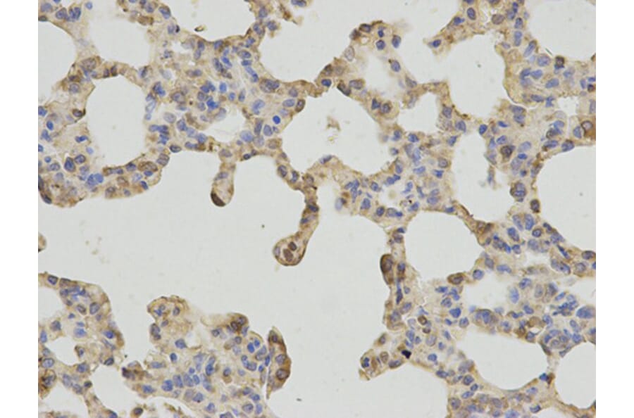 Immunohistochemistry - FTH1 Antibody from Signalway Antibody (32180) - Antibodies.com