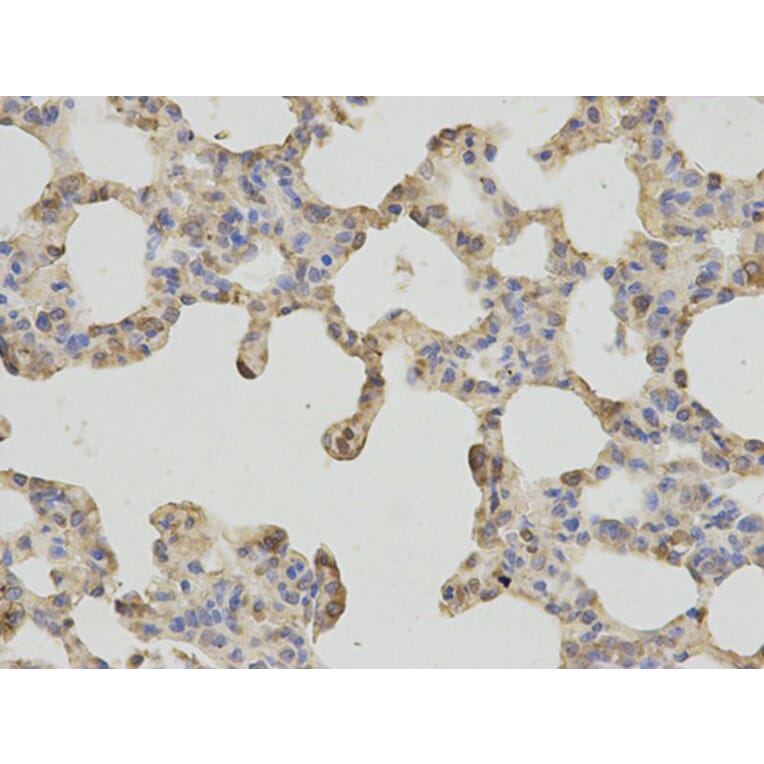 Immunohistochemistry - FTH1 Antibody from Signalway Antibody (32180) - Antibodies.com
