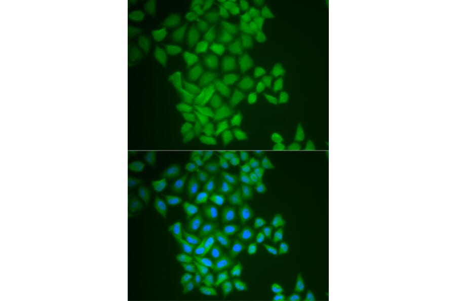 Immunofluorescence - FTH1 Antibody from Signalway Antibody (32180) - Antibodies.com