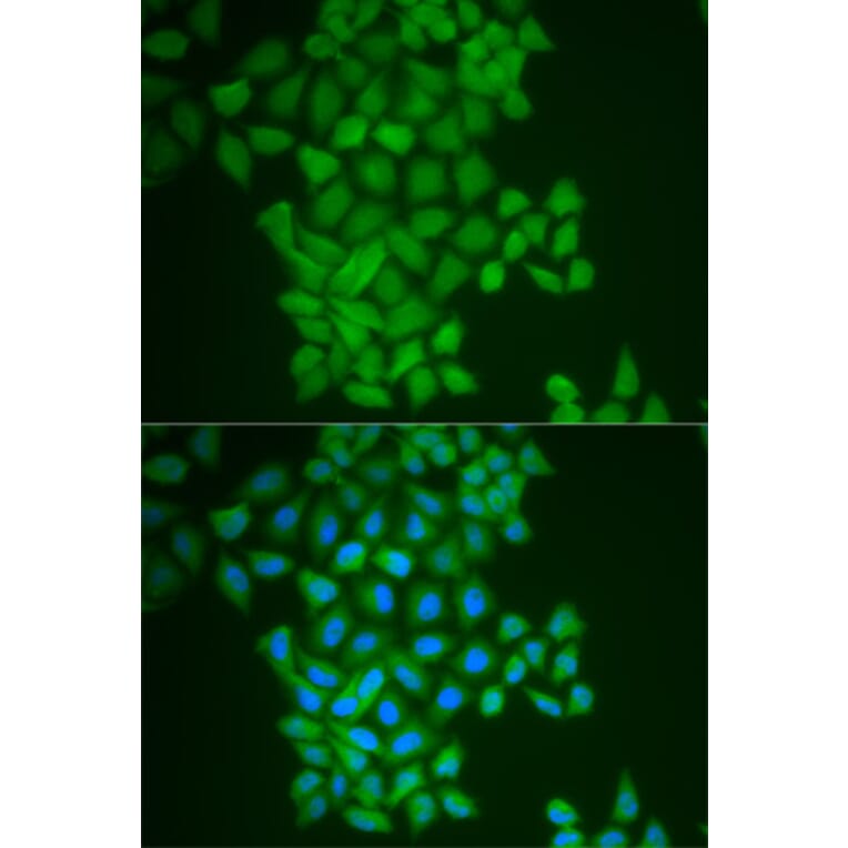 Immunofluorescence - FTH1 Antibody from Signalway Antibody (32180) - Antibodies.com