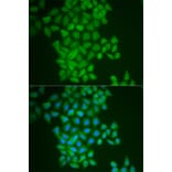 Immunofluorescence - FTH1 Antibody from Signalway Antibody (32180) - Antibodies.com