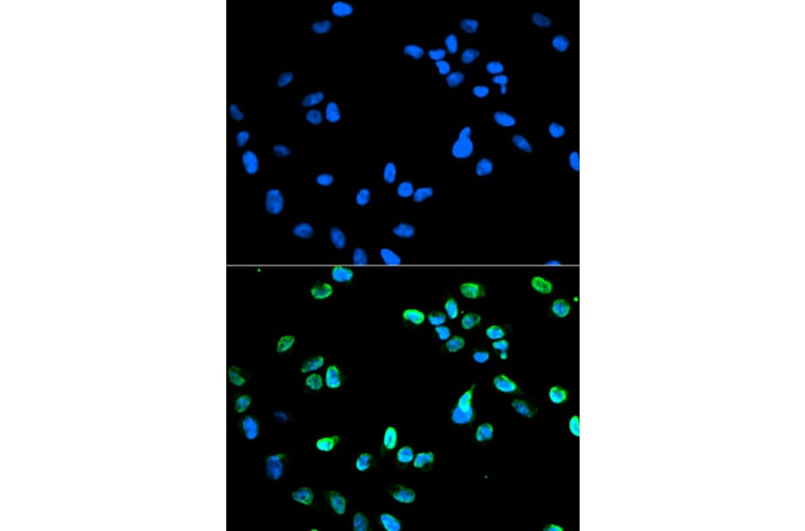 Immunofluorescence - IRF5 Antibody from Signalway Antibody (32184) - Antibodies.com