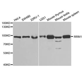 Western blot - RRM1 Antibody from Signalway Antibody (32186) - Antibodies.com