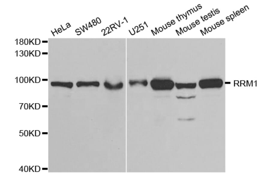 Western blot - RRM1 Antibody from Signalway Antibody (32186) - Antibodies.com