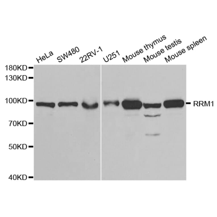 Western blot - RRM1 Antibody from Signalway Antibody (32186) - Antibodies.com