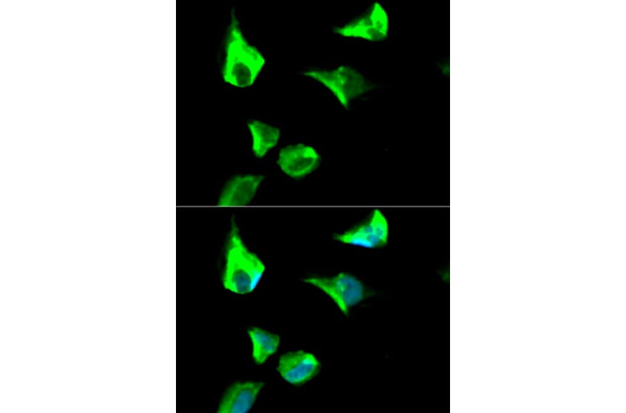 Immunofluorescence - RRM1 Antibody from Signalway Antibody (32186) - Antibodies.com