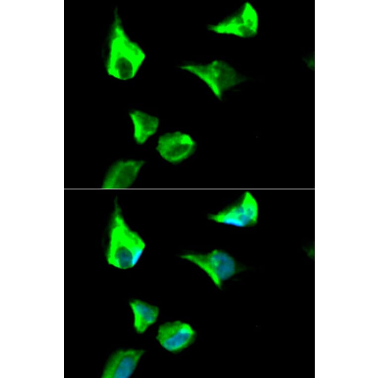 Immunofluorescence - RRM1 Antibody from Signalway Antibody (32186) - Antibodies.com