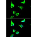Immunofluorescence - RRM1 Antibody from Signalway Antibody (32186) - Antibodies.com