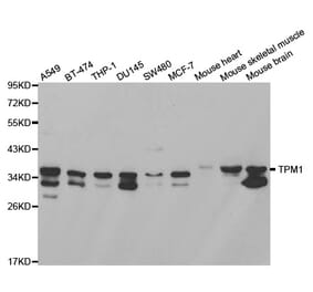 Western blot - TPM1 Antibody from Signalway Antibody (32189) - Antibodies.com