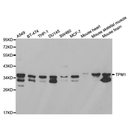 Western blot - TPM1 Antibody from Signalway Antibody (32189) - Antibodies.com