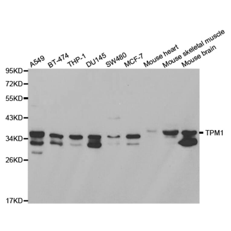 Western blot - TPM1 Antibody from Signalway Antibody (32189) - Antibodies.com