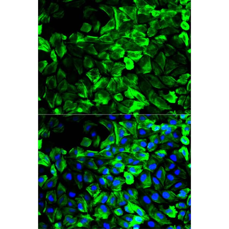 Immunofluorescence - TPM1 Antibody from Signalway Antibody (32189) - Antibodies.com