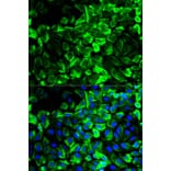 Immunofluorescence - TPM1 Antibody from Signalway Antibody (32189) - Antibodies.com