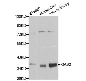 Western blot - GAS2 Antibody from Signalway Antibody (32198) - Antibodies.com